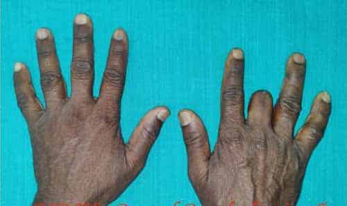 Prosthodontics