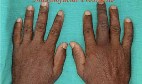 Prosthodontics